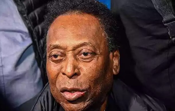 Pelé não responde à quimioterapia e está em cuidados paliativos